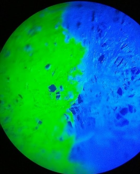 the same image, under a flourescent microscope